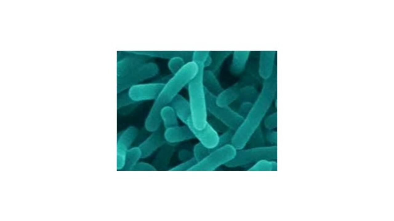 V Spojených štátoch zabíja nebezpečná baktéria listéria