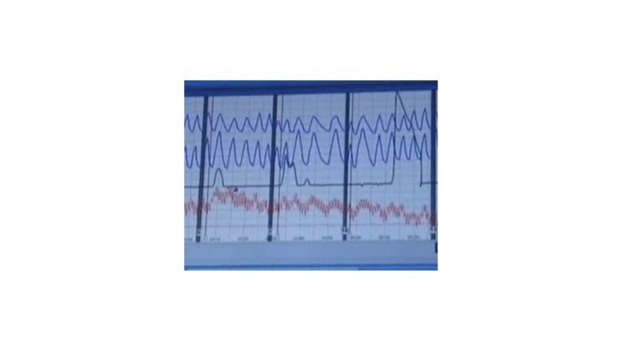 Hráči Lokomotivu Plovdiv pôjdu na detektor lži, prehrali s posledným