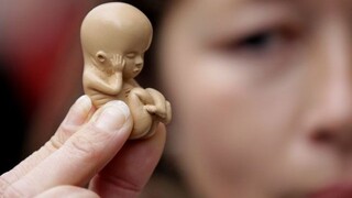 Počet potratov na Slovensku naďalej klesá, momentálne je na historickom minime