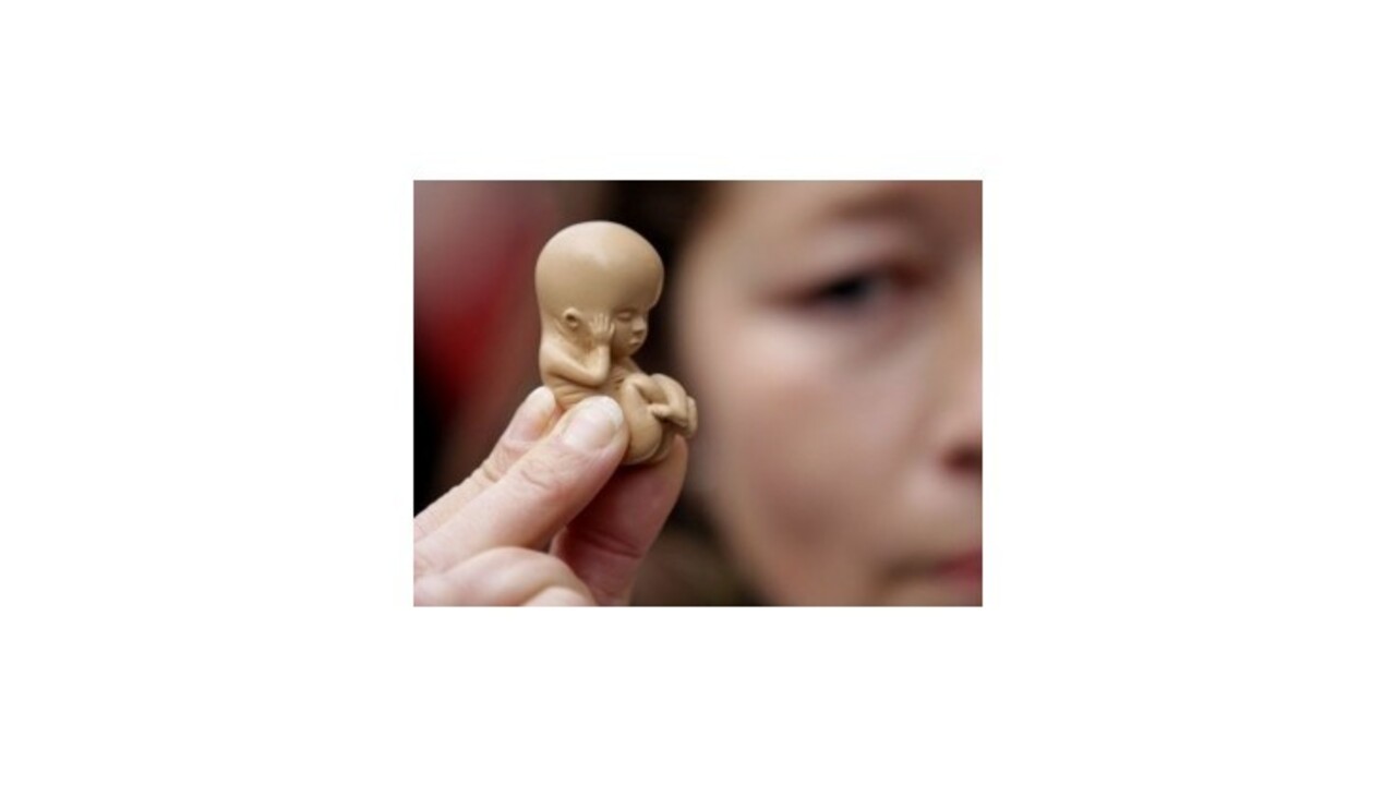 Francúzsko bude preplácať všetky interrupcie