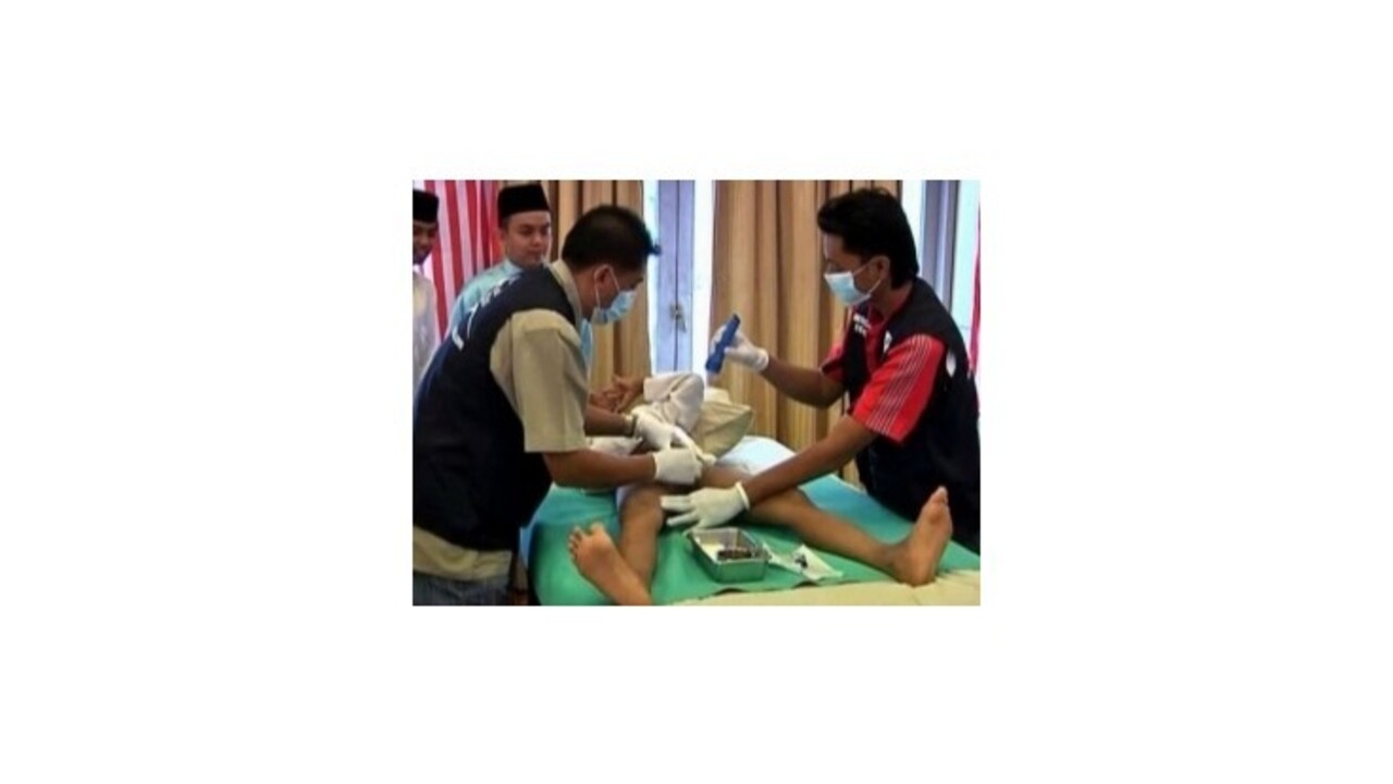 Nemecký parlament povolil mužskú obriezku