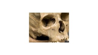 V Košiciach našli kostru neznámeho muža