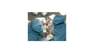 VšZP chce uprednostniť vo financovaní nemocníc tie, ktoré viac operujú