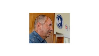 Lekári voperovali pacientovi do lebky unikátny slovenský implantát