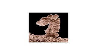 Vedci objavili antibiotikum, ktoré zabíja superbaktérie