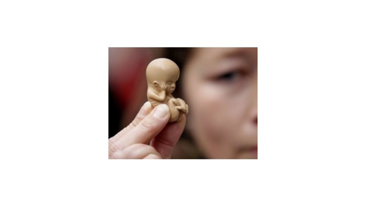 OĽaNO chce zákaz potratových tabletiek