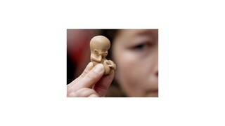 OĽaNO chce zákaz potratových tabletiek