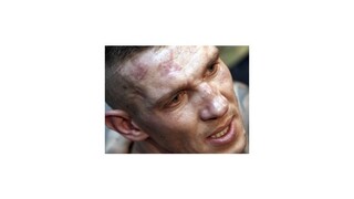 Tomi Kid prehral v San Antoniu so Šumenovom boj o tituly WBA a IBA