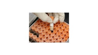 Kmeňové bunky dokážu vzniknúť aj z krviniek, zistili vedci