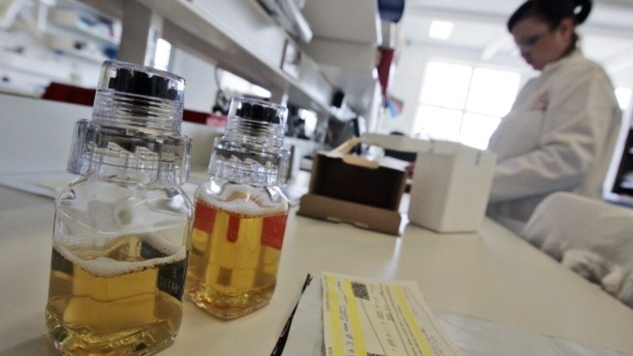 doping dopingové laboratórium steroidy test analýza vzorka moču (ČTK/AP)