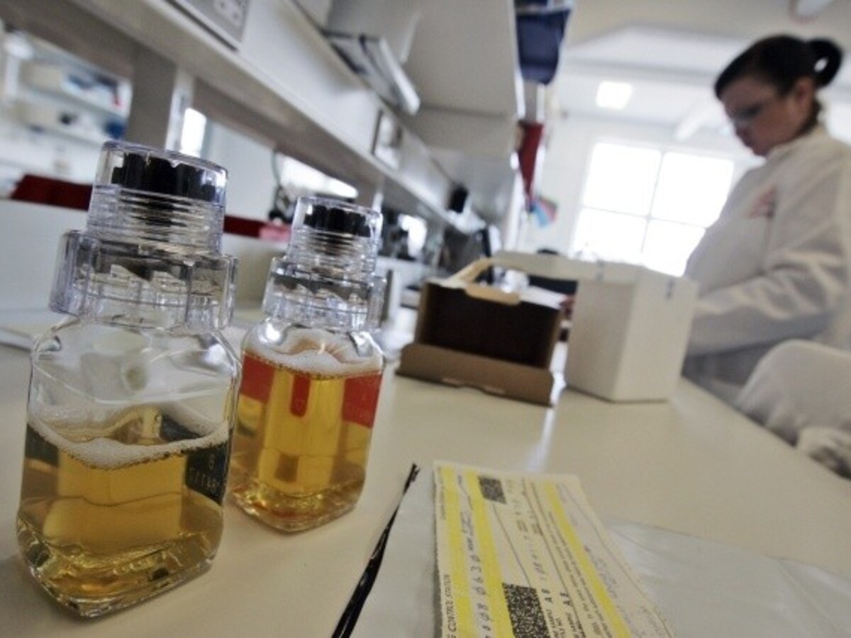doping dopingové laboratórium steroidy test analýza vzorka moču (ČTK/AP)