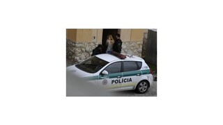 Modelka Kukučová sa mala brániť, má vytrhané vlasy