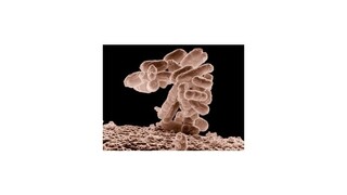 WHO: Baktérie rezistentné voči antibiotikám sa rozšírili po celom svete