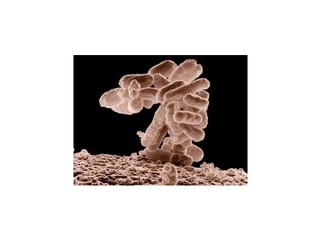 WHO: Baktérie rezistentné voči antibiotikám sa rozšírili po celom svete