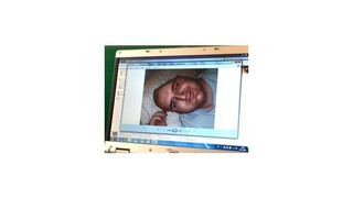 Špeciálny titánový implantát vrátil Jurajovi reč i samostatnosť