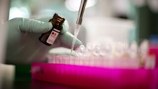laboratórium veda skúmavka (SITA/AP)
