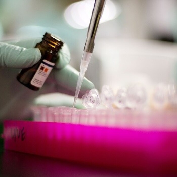 laboratórium veda skúmavka (SITA/AP)