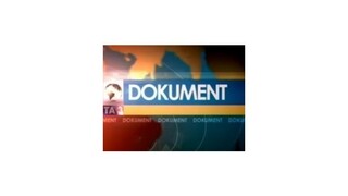 Drogy - Horelo mi telo