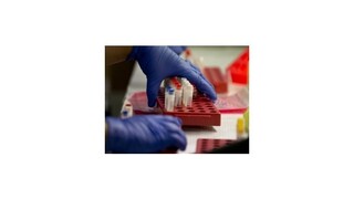 Českí vedci vyvinuli svetový unikát, domáci test na rakovinu