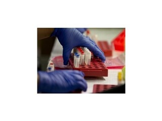 Českí vedci vyvinuli svetový unikát, domáci test na rakovinu