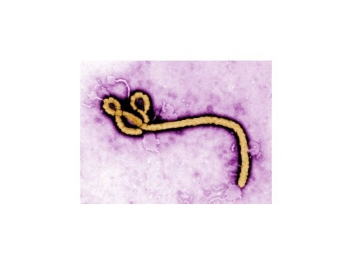 Libériu vyhlásili za oficiálne zbavenú eboly
