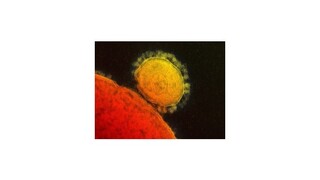 V Prahe prijali pacienta s podozrením na nákazu vírusom MERS