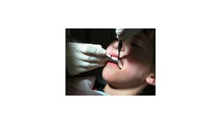 Mladí zubári vraj nie sú na povolanie pripravení, potrebujú ďalšie vzdelanie