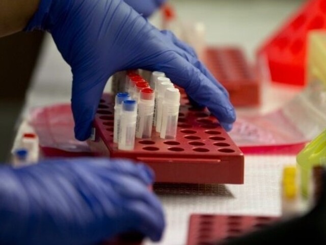 Na Slovensku zomrie každý rok asi 600 diabetikov