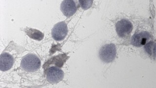 Vedci odhalili, ako vyrobili v skúmavke spermie
