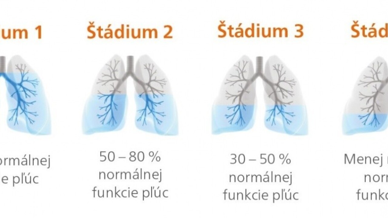 Rozdýchavate dlhšie, ako je zdravé?