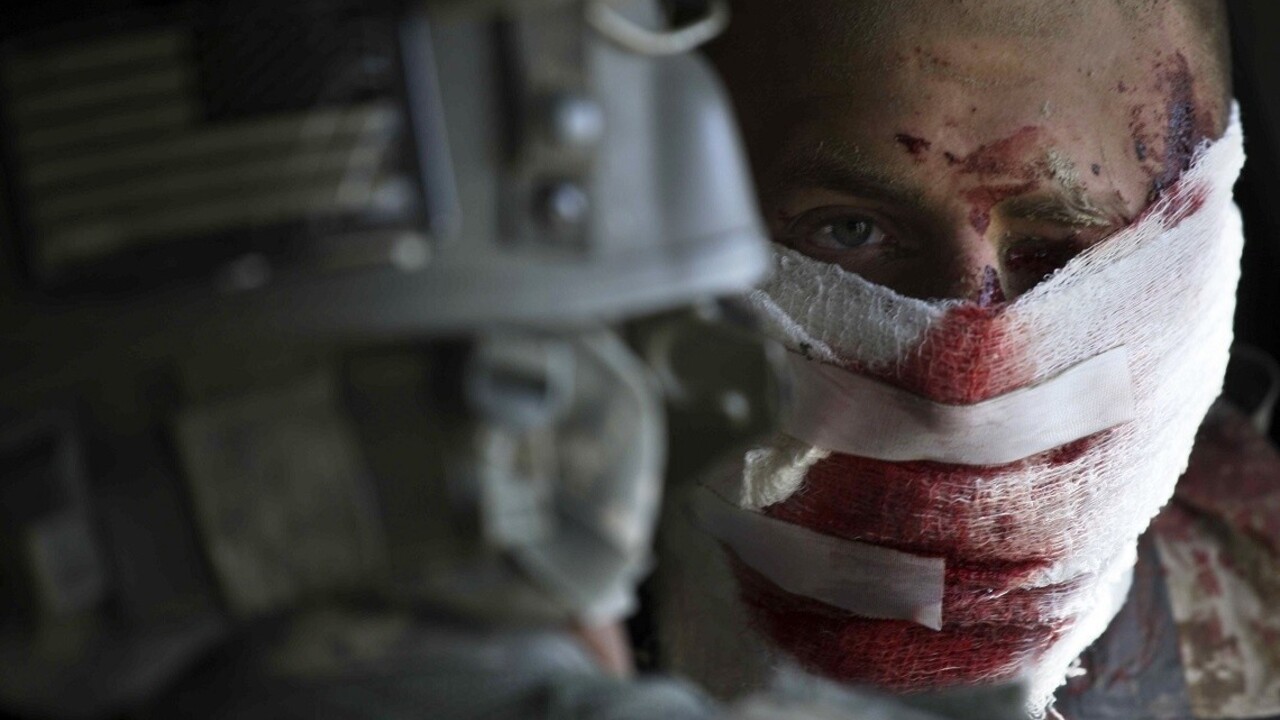 Americká armáda po útokoch šialencov poskytla prevratnú technológiu