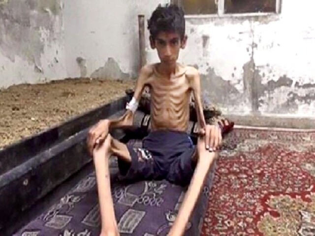 Humanitárni pracovníci budú mať prístup do sýrskych obcí sužovaných hladom