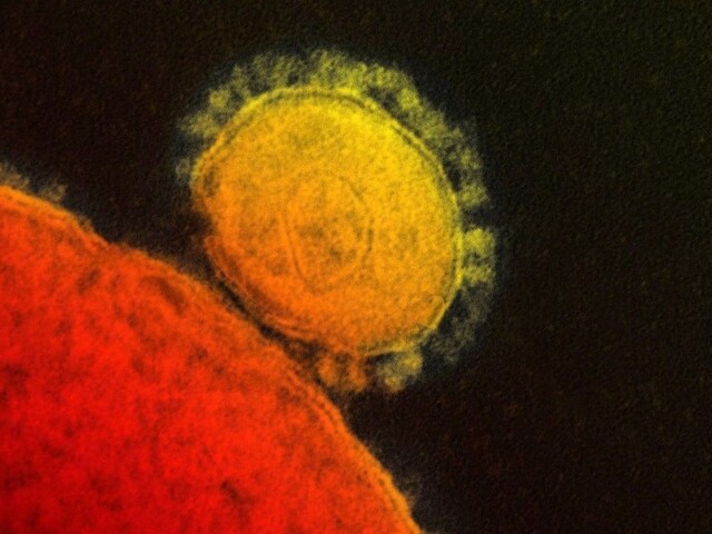 Lekári v Latinskej Amerike sú v pohotovosti, dôvodom je vírus Zika