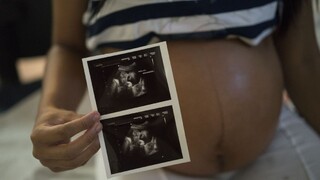 Tehotnej Španielke diagnostikovali vírus zika, ide o prvý prípad v Európe