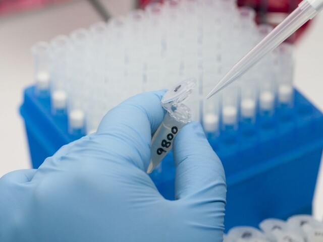 Vírus zika už aj na Slovensku? Hospitalizovali prvú pacientku