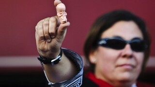 V Írsku musia ženy donosiť aj plod odsúdený na zánik, podľa OSN je to kruté