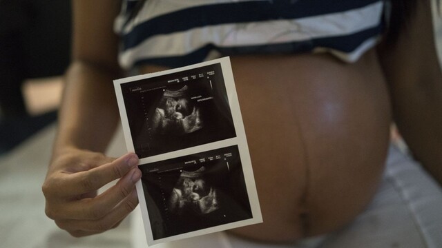 Vírus zika môže z Portorika ohroziť juh USA, varujú lekári