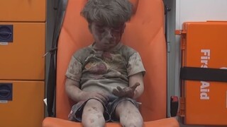 Krvavý a v šoku. Video s chlapčekom symbolizuje peklo v Sýrii