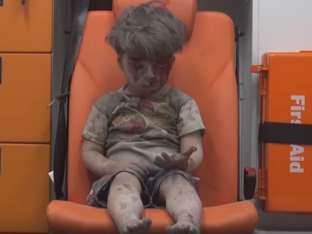Krvavý a v šoku. Video s chlapčekom symbolizuje peklo v Sýrii
