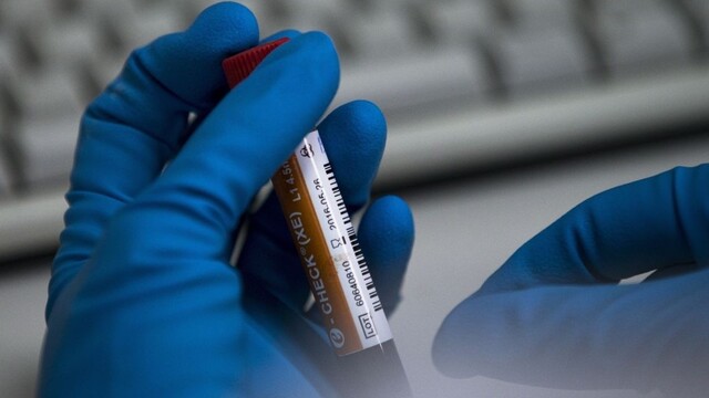 doping laboratórium vzorka testy 