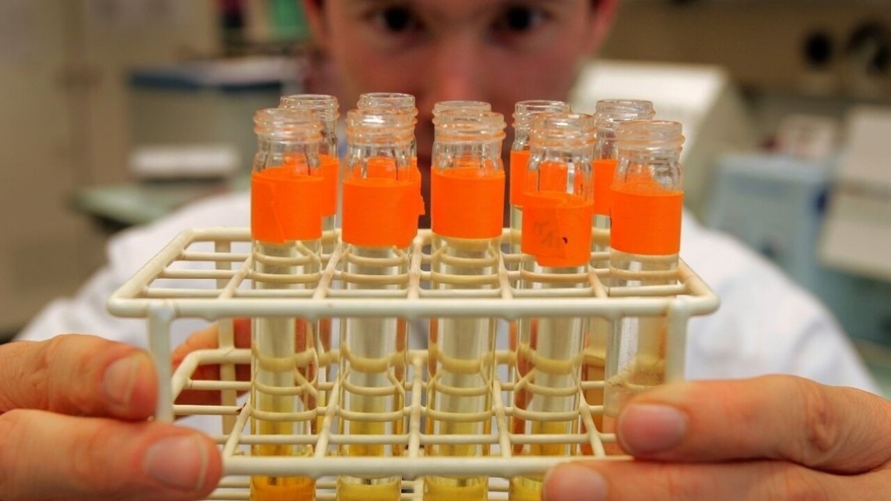 Slovenskí vedci chcú poraziť vírus HIV pomocou nanočastíc