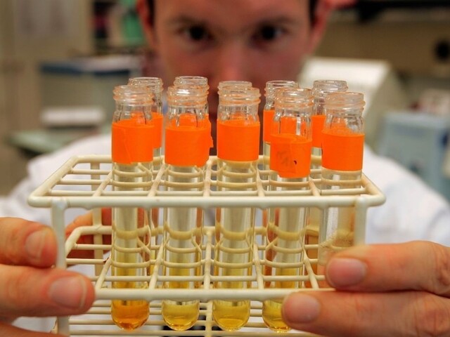 Slovenskí vedci chcú poraziť vírus HIV pomocou nanočastíc