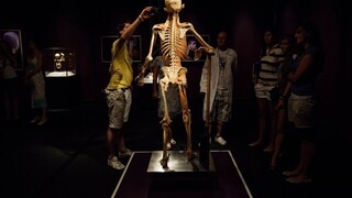 Matovičovcom sa nepáči bratislavská výstava o ľudskom tele