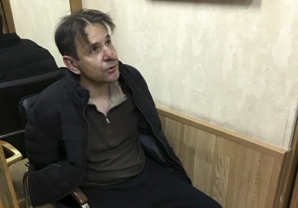 russia-journalist-attacked-44382-ebd9dc10a90a49369f5e2624f1e97bcb_a839bf93.jpg