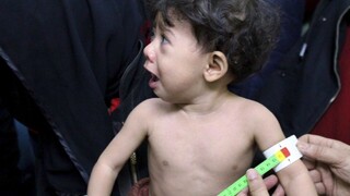 Situácia v sýrskej oblasti je kritická, začali evakuovať vážne chorých
