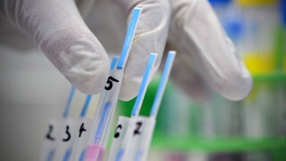 Infektológ A. Shunnar o víruse, ktorý k nám mieri z Austrálie