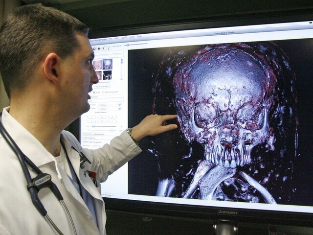 Vedci rozlúštili záhadu miniatúrnej múmie z púšte