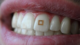 RFID senzor na zube kontroluje príjem cukru, soli a alkoholu
