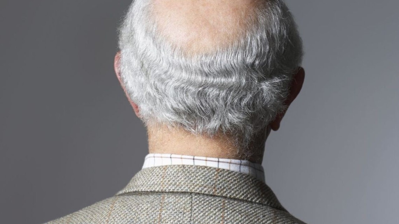 Hlava holá ako koleno straší mužov. Kto za to v skutočnosti môže?