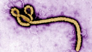 Ebola sa v Kongu rýchlo šíri, zasiahla aj miliónové mesto